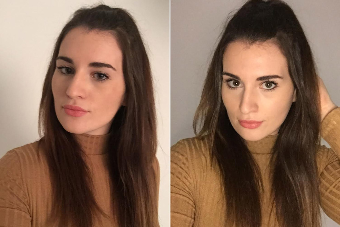 Antes y después | Foto: NYPost