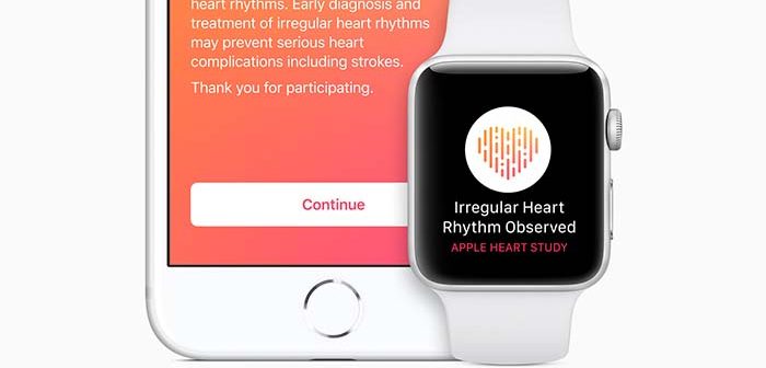 ritmo cardiaco irregular